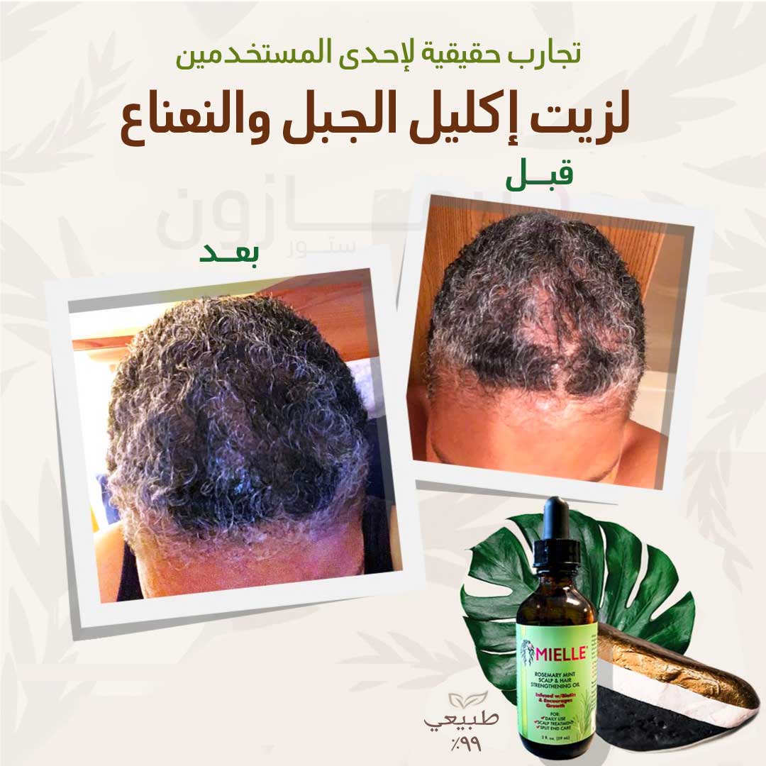 زيت ميلي للعناية بالشعر وفروة الرأس – Dermazone store UAE